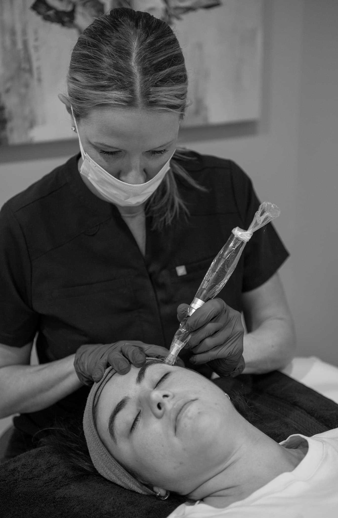 terra microneedling client bw — 512 Skincare